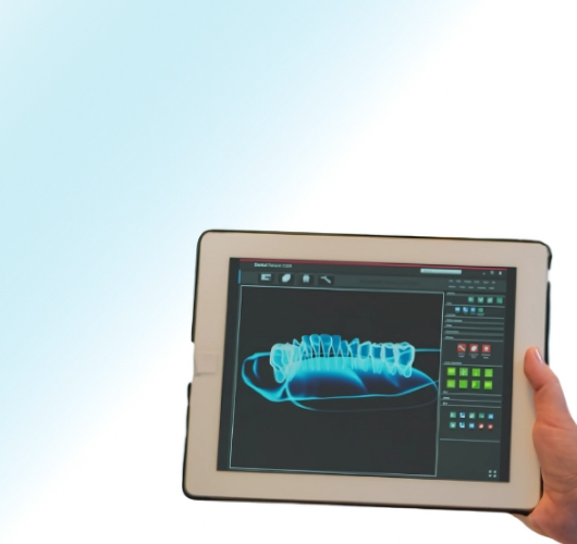 3D teeth model on a tablet screen